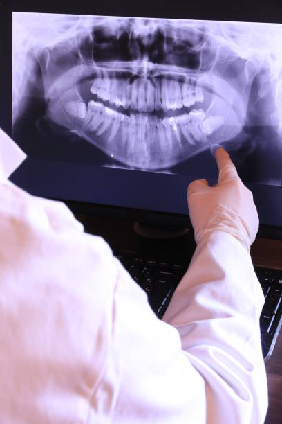 Best Emergency Dental Extractions in Cuba, MO